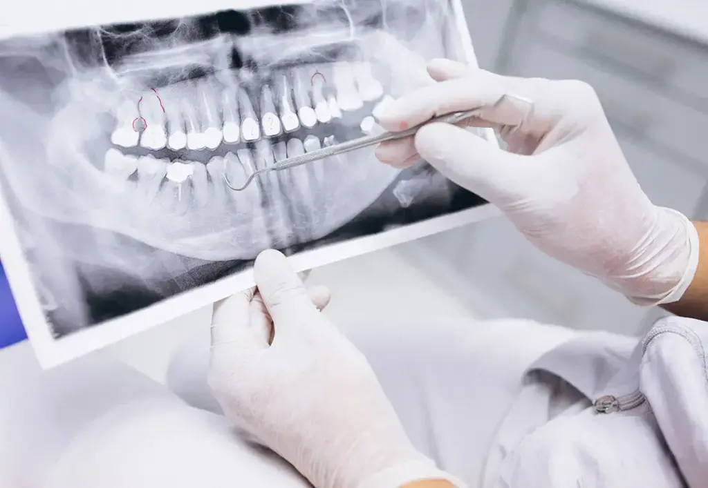 Clínica Dental en Alicante