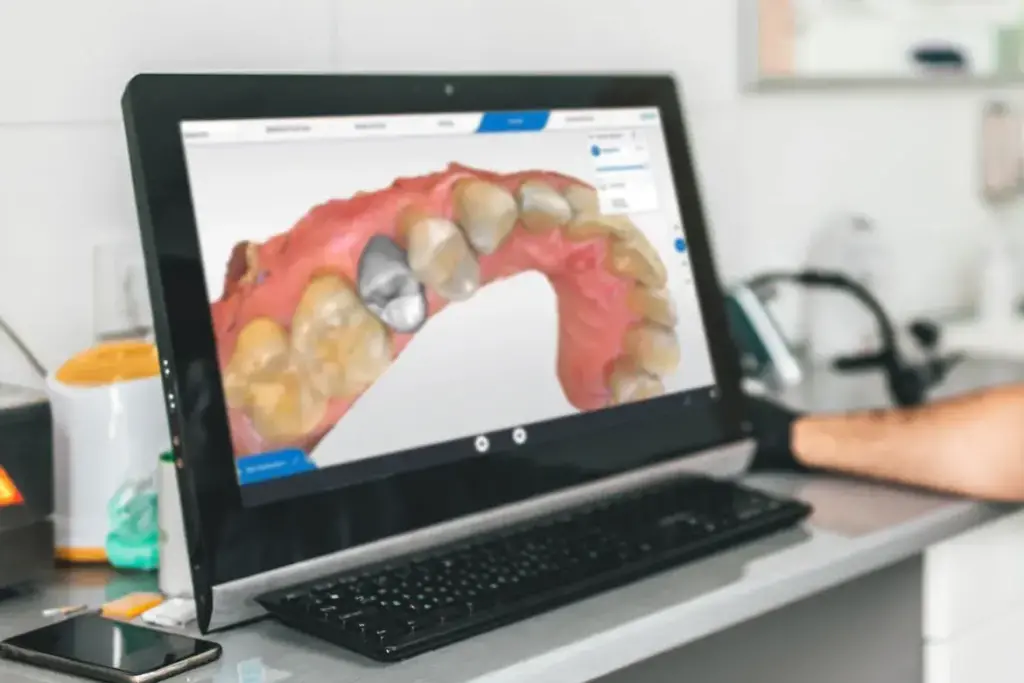 Clínica Dental en Alicante